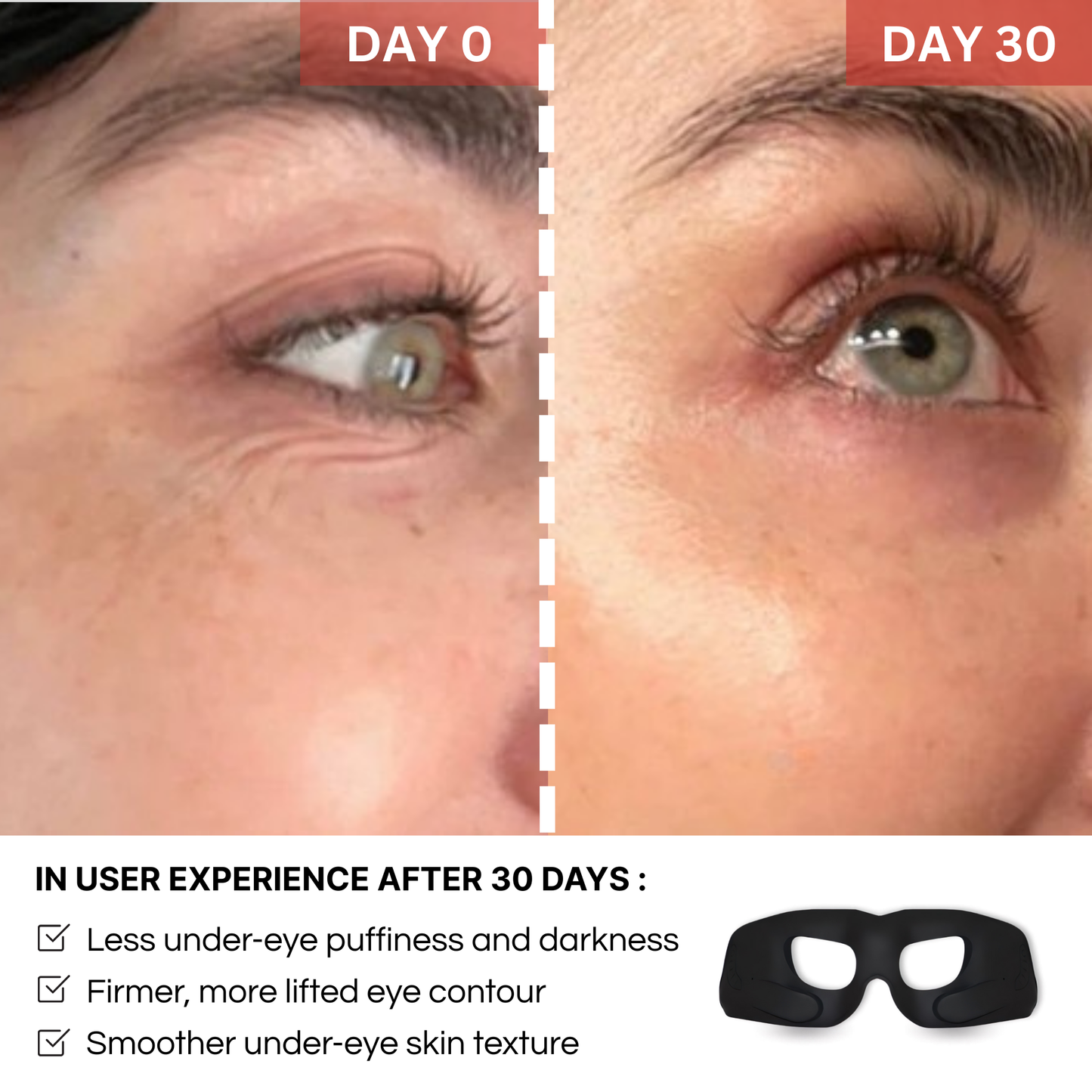 Glowiapro™ EMS EYE MASK