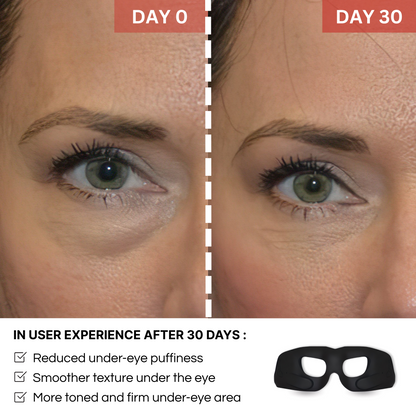 Glowiapro™ EMS EYE MASK