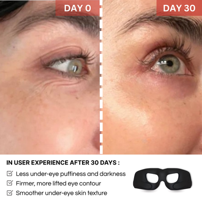 Glowiapro™ EMS EYE MASK