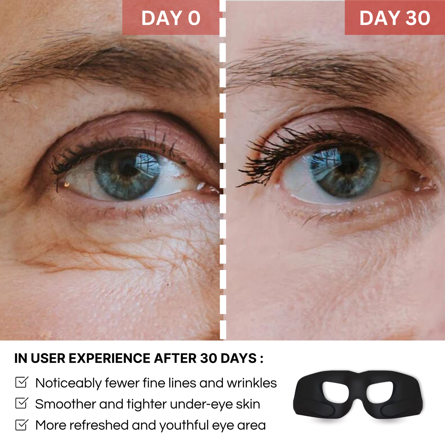 Glowiapro™ EMS EYE MASK
